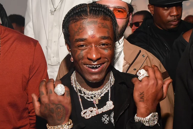 Photo of Lil Uzi Vert's Multimillion Dollar Pink Diamond Implanted in His Forehead Surfaces